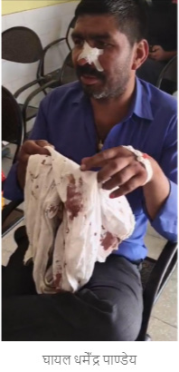 घायल दुकानदार को नहीं मिला समय पर इलाज, खानपुर सीएचसी में डॉक्टर गायब मिलने पर बढ़ा आक्रोश
